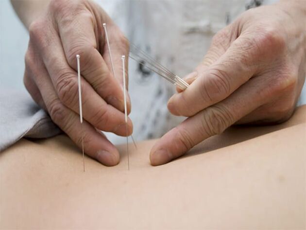 Akupunktur bei Prostatitis